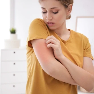 Alergiile sezoniere și urticaria alergică