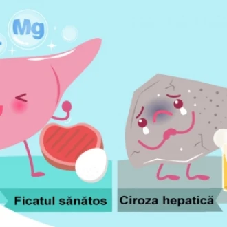 Alimentația pacienților cu ciroză hepatică 